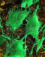 Cancerous Cells